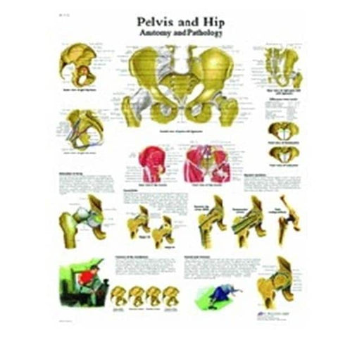 3B Scientific GMBH Pelvis and Hip 20x26" Anatomical Chart Ea - 12-4617L