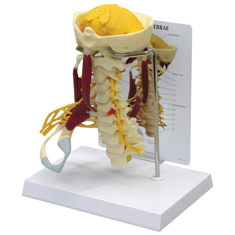 3bscientific Deluxe Muscled Cervical Spine - 1019511