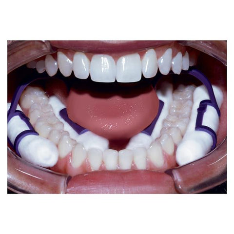 Pascal Co Inc Cotton Roll Holder Isolators Purple 50/Box - 28-100