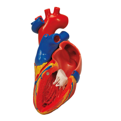 3B Scientific Anatomical Model - heart with bypass, 2-part - Includes 3B Smart Anatomy