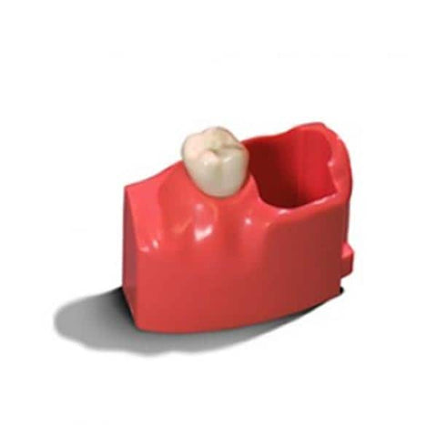 Acadental Teeth Model 12-15 MEL Acadental Left Each - RT-AE13-15-M2