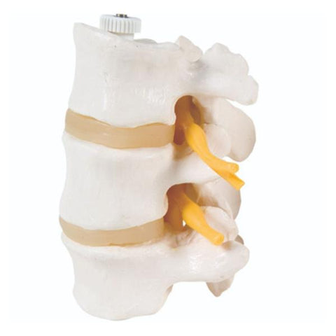 Fabrication Enterprises 3 Lumbar Vertebrae Model Anatomical Each - 35400