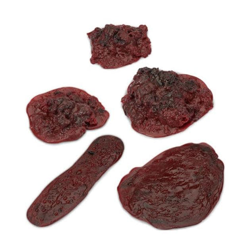 Nasco Healthcare, Inc Clot/Hemorrhage Model Set Life/form Each - LF00714