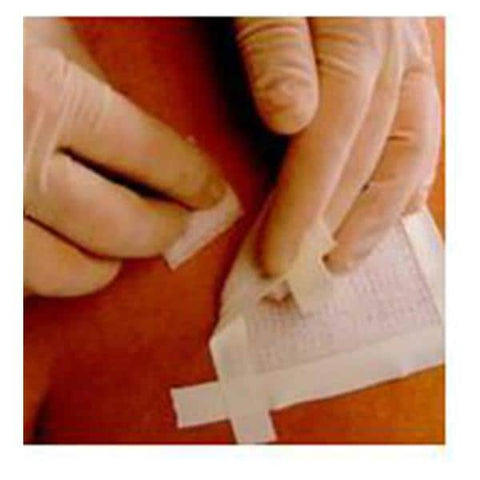 Smith & Nephew Wound Care Wipe Accessory Remove 50/Bx, 20 BX/CA - 403100