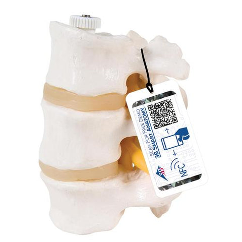 3 Human Lumbar Vertebrae, Flexibly Mounted - 3B Smart Anatomy
