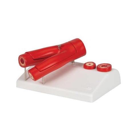 Arteriosclerosis Model, with Cross Section of Artery, 2 part - 3B Smart Anatomy