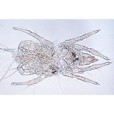 Air Pollution and Allergens - French