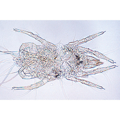 Air Pollution and Allergens - German Slides