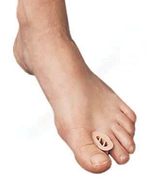 Bird & Cronin Toe Spreader | Pack of 12