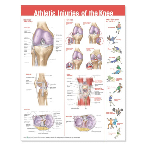 Athletic Injuries of the Knee Chart (Packaging - Each)