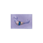 Serola Gel Arc Elbow Brace