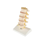 Anatomical Spine Model (Packaging - Each)