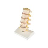 Anatomical Spine Model (Packaging - Each)
