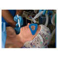 Dupaco Opti-Guard Foam Eye Protector Sterile Large Not Made With Natural Rubber Latex  - 28310