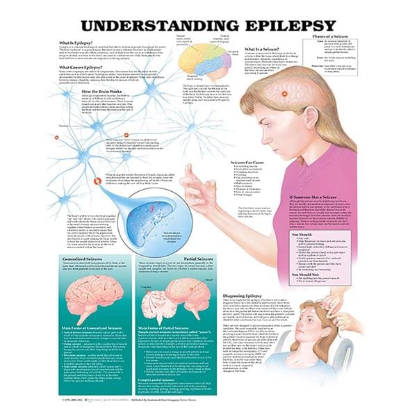 Wolters Kluwer Health Inc Understanding Epilepsy 20x26" Educational Chart EA - 9781587793356