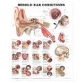 Wolters Kluwer Health Inc Middle Ear Conditions 20x26" Anatomical Chart Ea - 9781605470962
