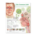 Wolters Kluwer Health Inc Understanding Type 1 Diabetes 20x26" Anatomical Chart Ea- 9781469894935