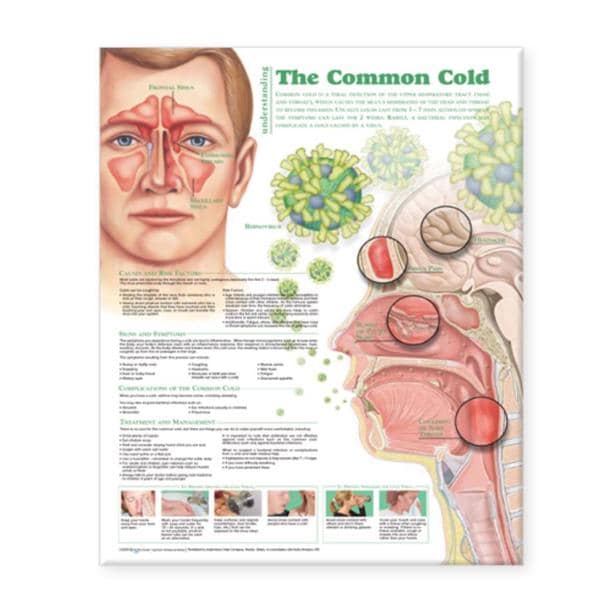 Wolters Kluwer Health Inc Understanding Type 1 Diabetes 20x26" Anatomical Chart Ea- 9781469894935