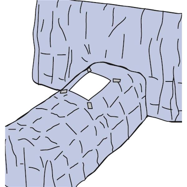 3M Medical Products Steri-Drape 285cm x 182cm Sterile Laparatomy/Laparoscopy Drape Fenestrated - 1031
