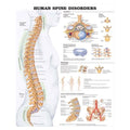 Wolters Kluwer Health Inc Human Spine Disorders 20x26" Educational Chart Ea - 9781587794650
