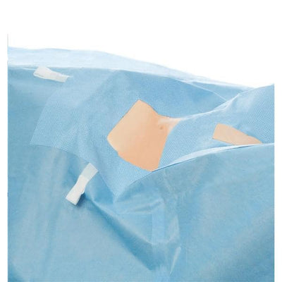 O & M Halyard -104x35x104" Sterile Laparoscopy/Pelviscopy Drape Fenestrated 89222