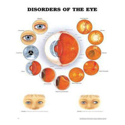 Wolters Kluwer Health Inc Disorder of the Eye 20x26" Educational Chart Ea - 9781587799259