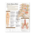 Wolters Kluwer Health Inc Understanding Lower Back Pain 20x26" Anatomical Chart Ea - 9780781782432