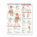Wolters Kluwer Health Inc Anatomy and Injuries of the Hand and Wrist 20x26" Anatomical Chart Ea - 9781587799143