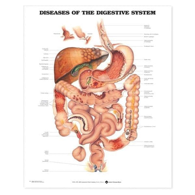Wolters Kluwer Health Inc Diseases of The Digestive System 20x26" Educational Chart Ea - 9781587792373