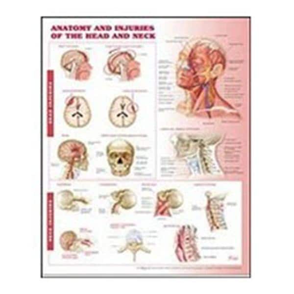 Lippincott Williams @ Wilkins Anatomy and Injuries of the Head and Neck 20x26" Anatomical Chart Ea - 9780781786713