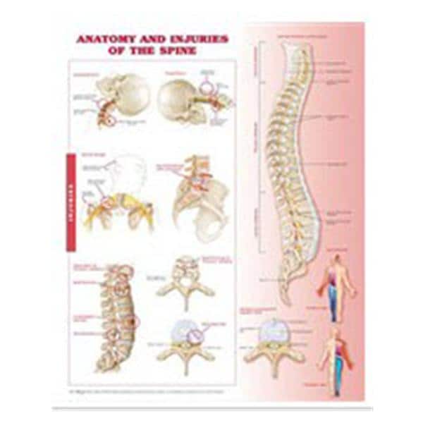 Lippincott Williams @ Wilkins Anatomy and Injuries of the Spine 20x26" Anatomical Chart Ea - 9780781786676