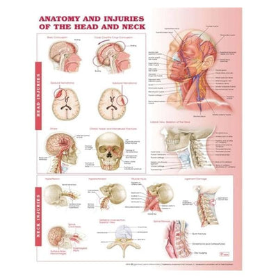 Wolters Kluwer Health Inc Anatomy and Injuries of the Head and Neck 20x26" Anatomical Chart Ea - 9780781786713