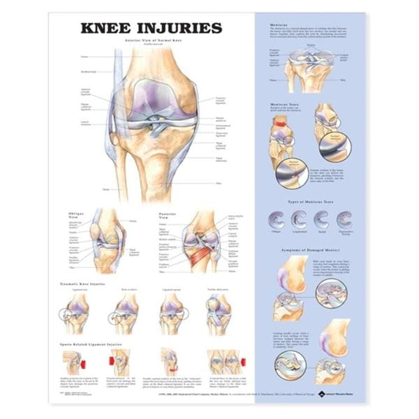 Wolters Kluwer Health Inc Knee Injuries 20x26" Anatomical Chart Ea - 9781587797569