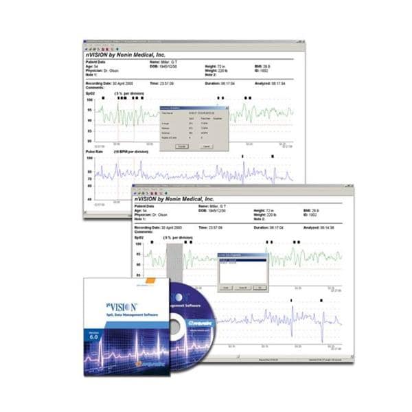 Nonin Medical nVision Software System f/ Nonin Pulse Ox models with memory Each - 3211-000