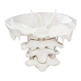 Wolters Kluwer Health Inc Atlas/Axis Anatomical Model Ea  - Z4083