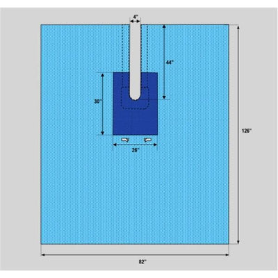 Welmed Inc -82x126" Sterile Surgical Drape Fenestrated 1222-1925