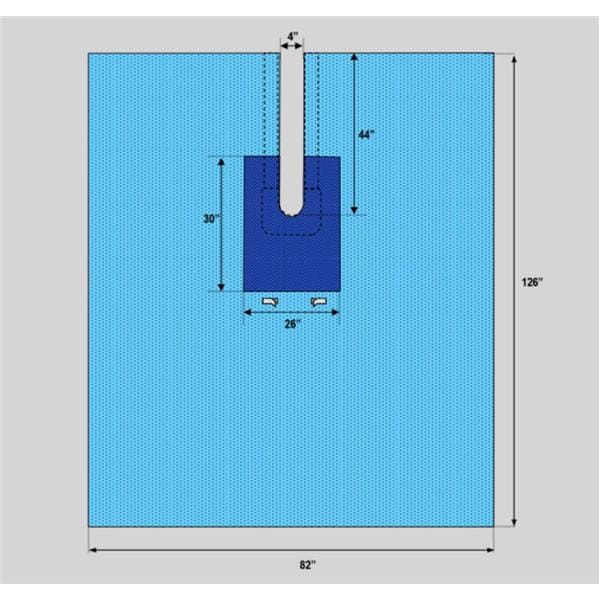 Welmed Inc -82x126" Sterile Surgical Drape Fenestrated 1222-1925