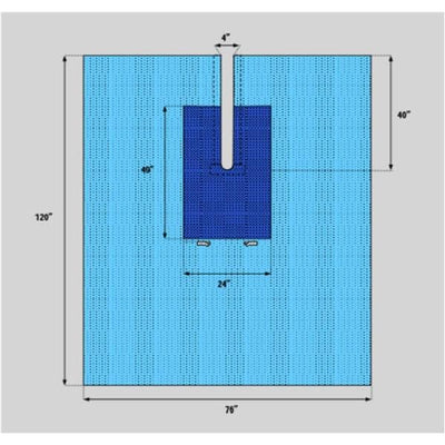 Welmed Inc -77x120" Non-Sterile Surgical Drape Fenestrated 1222-1950