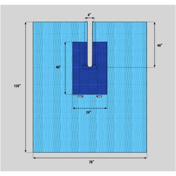 Welmed Inc -77x120" Non-Sterile Surgical Drape Fenestrated 1222-1950