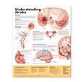 Wolters Kluwer Health Inc Stroke 20x26" Anatomical Chart Ea - 9781587799884