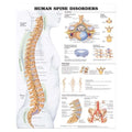 Wolters Kluwer Health Inc Vertebral Column 20x26" Anatomical Chart Ea - 9781587794438