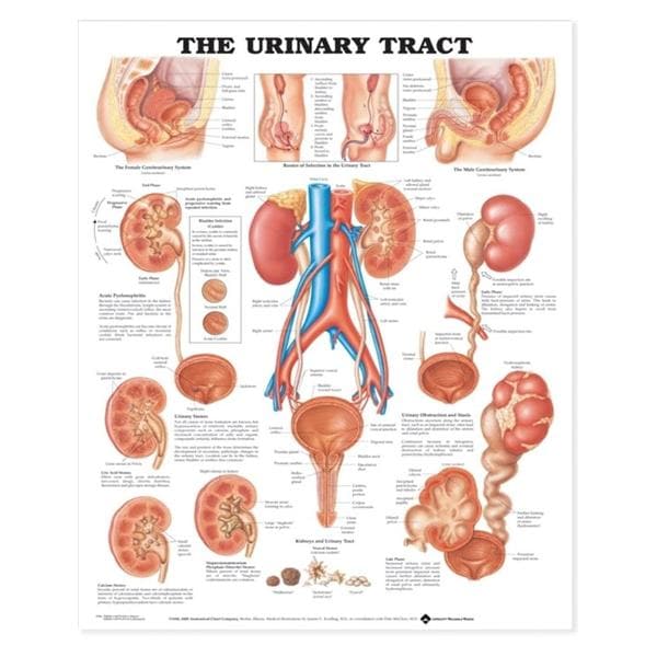 Wolters Kluwer Health Inc Urinary Tract 20x26" Educational Chart Ea - 9781587790713