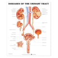 Wolters Kluwer Health Inc Diseases of Urine Tract 20x26" Educational Chart Ea - 9781587792410