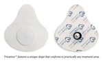 North Coast Trivarion® Iontophoresis Delivery Kit ( Packaging - 12 )