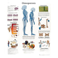 Fabrication Enterprises Spinal Column 20x25" Anatomical Chart Ea - 12-4615L