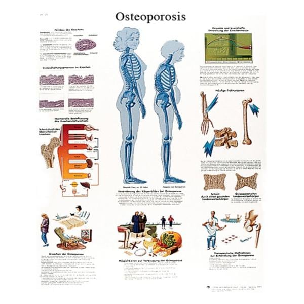 Fabrication Enterprises Spinal Column 20x25" Anatomical Chart Ea - 12-4615L