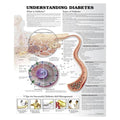 Wolters Kluwer Health Inc Understanding Diabetes 20x26" Educational Chart Ea - 9781469894898