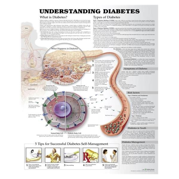 Wolters Kluwer Health Inc Understanding Diabetes 20x26" Educational Chart Ea - 9781469894898