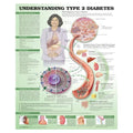 Wolters Kluwer Health Inc Understanding Type 2 Diabetes 20x26" Educational Chart Ea - 9781469894980