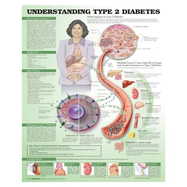 Wolters Kluwer Health Inc Understanding Type 2 Diabetes 20x26" Educational Chart Ea - 9781469894980